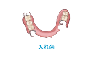 入れ歯
